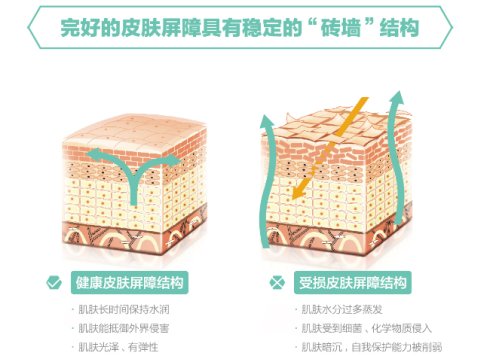 红血丝形成的原因有哪些?脸上有红血丝怎么去除?